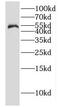 Tubulin Gamma 1 antibody, FNab03337, FineTest, Western Blot image 