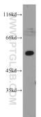 TGF-Beta Activated Kinase 1 (MAP3K7) Binding Protein 1 antibody, 14819-1-AP, Proteintech Group, Western Blot image 