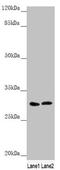 Synaptosome Associated Protein 29 antibody, LS-C676526, Lifespan Biosciences, Western Blot image 