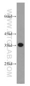 Ribose-phosphate pyrophosphokinase 1 antibody, 15549-1-AP, Proteintech Group, Western Blot image 