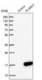 Plasminogen Receptor With A C-Terminal Lysine antibody, NBP1-89254, Novus Biologicals, Western Blot image 