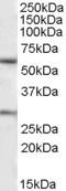 Potassium Voltage-Gated Channel Subfamily Q Member 1 antibody, orb20163, Biorbyt, Western Blot image 