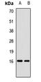 Actin Related Protein 2/3 Complex Subunit 5 antibody, orb412790, Biorbyt, Western Blot image 
