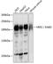 ERBB2 antibody, GTX35231, GeneTex, Western Blot image 