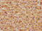 Glutamic-Oxaloacetic Transaminase 1 antibody, CSB-PA009679HA01HU, Cusabio, Immunohistochemistry paraffin image 