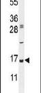 Ubiquitin A-52 Residue Ribosomal Protein Fusion Product 1 antibody, PA5-23685, Invitrogen Antibodies, Western Blot image 