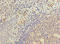 KIR3DL3 antibody, LS-C675949, Lifespan Biosciences, Immunohistochemistry paraffin image 
