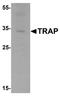 Acid Phosphatase 5, Tartrate Resistant antibody, TA326625, Origene, Western Blot image 