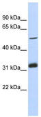 Tandem C2 Domains, Nuclear antibody, TA338817, Origene, Western Blot image 