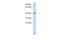 SET And MYND Domain Containing 3 antibody, 26-556, ProSci, Western Blot image 