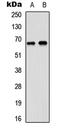 DEAD-Box Helicase 5 antibody, abx121384, Abbexa, Western Blot image 