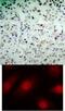 RB Transcriptional Corepressor 1 antibody, 79-164, ProSci, Immunohistochemistry paraffin image 