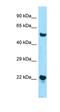 Zinc Finger DHHC-Type Containing 12 antibody, orb326366, Biorbyt, Western Blot image 