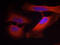 Keratin 8 antibody, LS-C336029, Lifespan Biosciences, Immunofluorescence image 