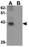 TRNA Methyltransferase 12 Homolog antibody, GTX32015, GeneTex, Western Blot image 