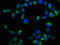 Neurotensin Receptor 2 antibody, LS-C672647, Lifespan Biosciences, Immunofluorescence image 