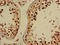 GA Binding Protein Transcription Factor Subunit Beta 1 antibody, LS-C678019, Lifespan Biosciences, Immunohistochemistry paraffin image 