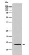 Cytochrome C, Somatic antibody, M03529-2, Boster Biological Technology, Western Blot image 