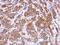 Irag antibody, NBP2-16987, Novus Biologicals, Immunohistochemistry frozen image 