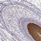 Hair keratin, type I Ha1 antibody, HPA055194, Atlas Antibodies, Immunohistochemistry paraffin image 