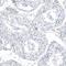 Solute Carrier Family 22 Member 2 antibody, NBP1-89417, Novus Biologicals, Immunohistochemistry paraffin image 