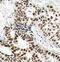 BRCA1 DNA Repair Associated antibody, GTX38676, GeneTex, Immunohistochemistry paraffin image 