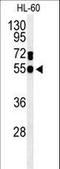 Guanine Deaminase antibody, LS-C166421, Lifespan Biosciences, Western Blot image 