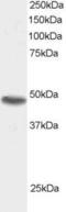 Sorting Nexin 15 antibody, LS-C55499, Lifespan Biosciences, Western Blot image 