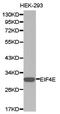 Eukaryotic Translation Initiation Factor 4E antibody, LS-C192761, Lifespan Biosciences, Western Blot image 