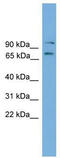 EOMES antibody, TA342257, Origene, Western Blot image 