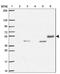 TRNA Splicing Endonuclease Subunit 54 antibody, NBP2-30377, Novus Biologicals, Western Blot image 