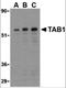 TGF-Beta Activated Kinase 1 (MAP3K7) Binding Protein 1 antibody, 3387, ProSci Inc, Western Blot image 