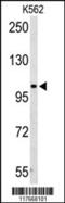 Adenosine Monophosphate Deaminase 2 antibody, 63-786, ProSci, Western Blot image 