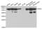 Arylsulfatase A antibody, abx001447, Abbexa, Western Blot image 