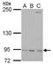 Ribonucleotide Reductase Catalytic Subunit M1 antibody, NBP2-20231, Novus Biologicals, Western Blot image 