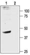 Potassium Voltage-Gated Channel Subfamily J Member 6 antibody, PA5-77575, Invitrogen Antibodies, Western Blot image 