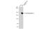 Thrombospondin 2 antibody, GTX635392, GeneTex, Western Blot image 