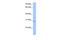 Defective In Cullin Neddylation 1 Domain Containing 3 antibody, GTX45582, GeneTex, Western Blot image 