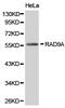 RAD9 Checkpoint Clamp Component A antibody, LS-C192887, Lifespan Biosciences, Western Blot image 