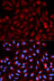 Proteasome Activator Subunit 3 antibody, 13-119, ProSci, Immunofluorescence image 
