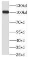 Oxysterol Binding Protein Like 3 antibody, FNab06021, FineTest, Western Blot image 