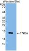 Progesterone Receptor antibody, LS-C296052, Lifespan Biosciences, Western Blot image 