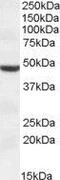 Transmembrane protease serine 4 antibody, GTX47593, GeneTex, Western Blot image 