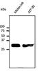 MutY DNA Glycosylase antibody, orb153336, Biorbyt, Western Blot image 