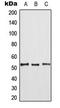 Mitogen-Activated Protein Kinase Kinase Kinase 8 antibody, LS-C353944, Lifespan Biosciences, Western Blot image 
