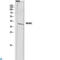 Inhibin Subunit Beta C antibody, LS-C814159, Lifespan Biosciences, Western Blot image 