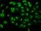 MN1 Proto-Oncogene, Transcriptional Regulator antibody, 204671-T02, Sino Biological, Immunohistochemistry paraffin image 