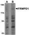 FERM And PDZ Domain Containing 1 antibody, NBP1-77082, Novus Biologicals, Western Blot image 