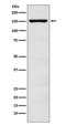 Adenosine Deaminase RNA Specific antibody, M00869, Boster Biological Technology, Western Blot image 