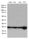 O-6-Methylguanine-DNA Methyltransferase antibody, M01012-1, Boster Biological Technology, Western Blot image 